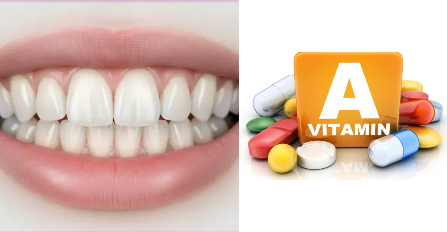 oral vitamin a 2